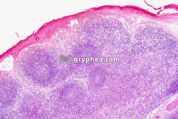 Thymus x20 - gryphea.org
